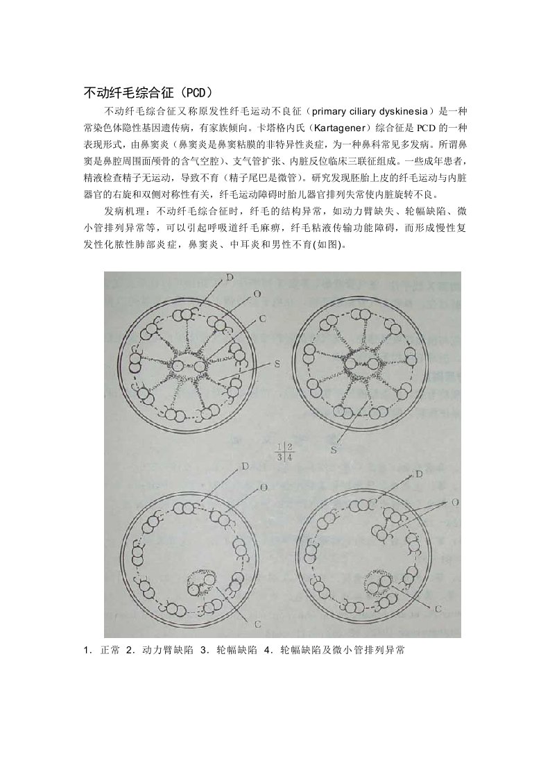 细胞生物学一些病症机理