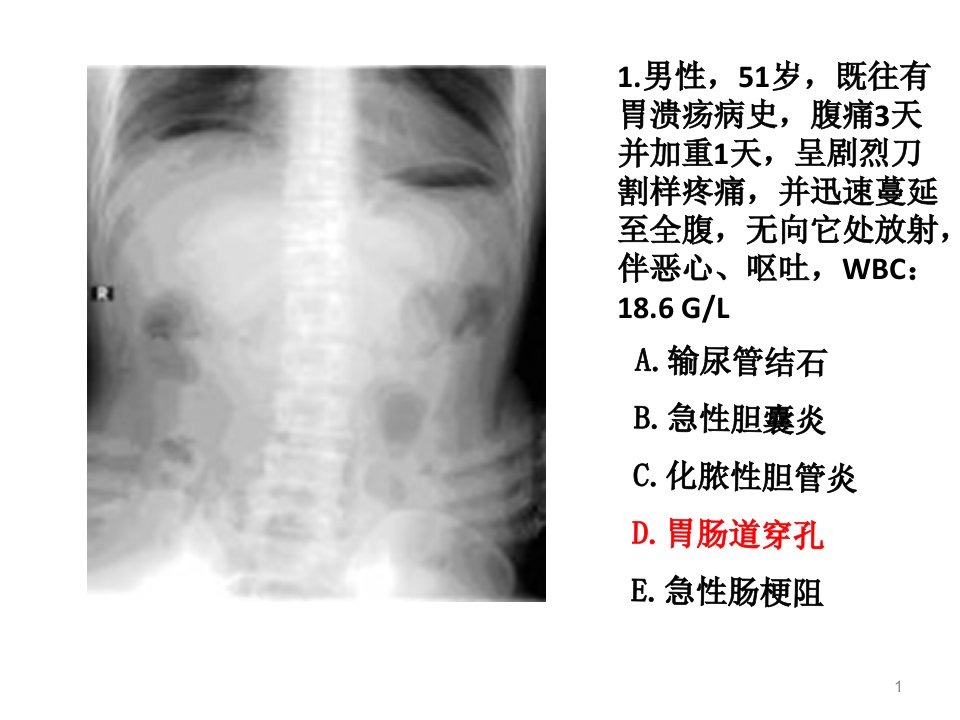 住院医师规陪出科考试辅助检查1