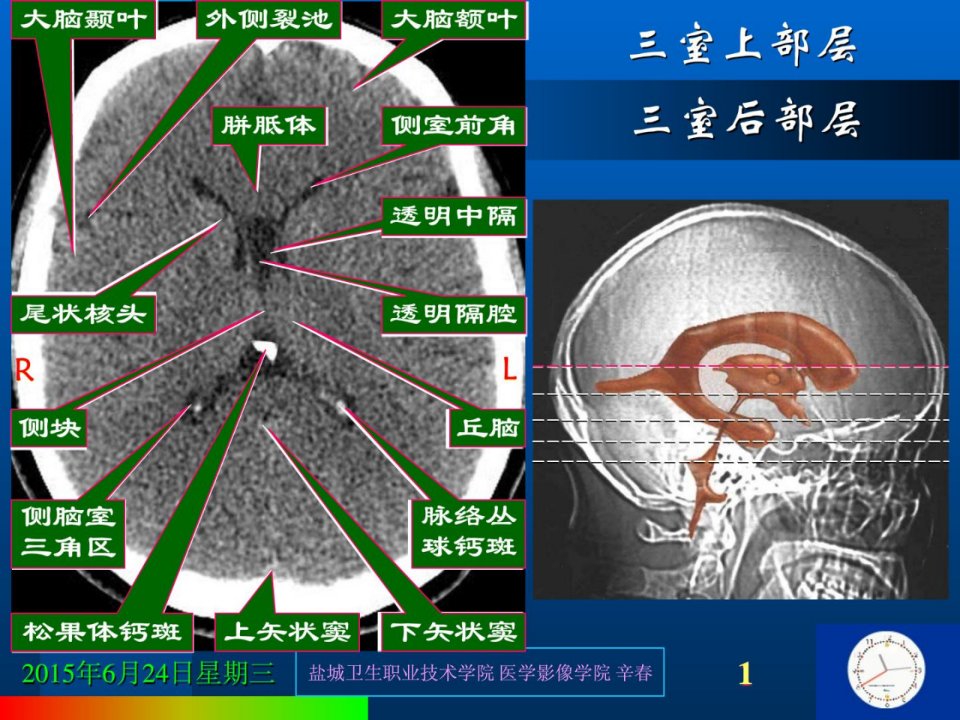 指南]医学影像诊断学