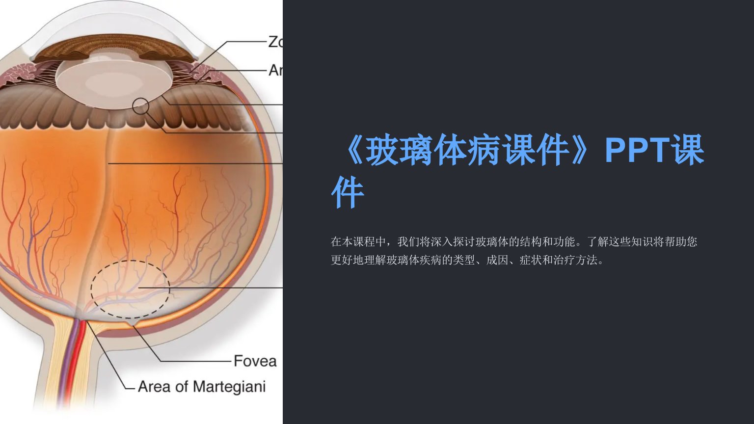 《玻璃体病课件》课件