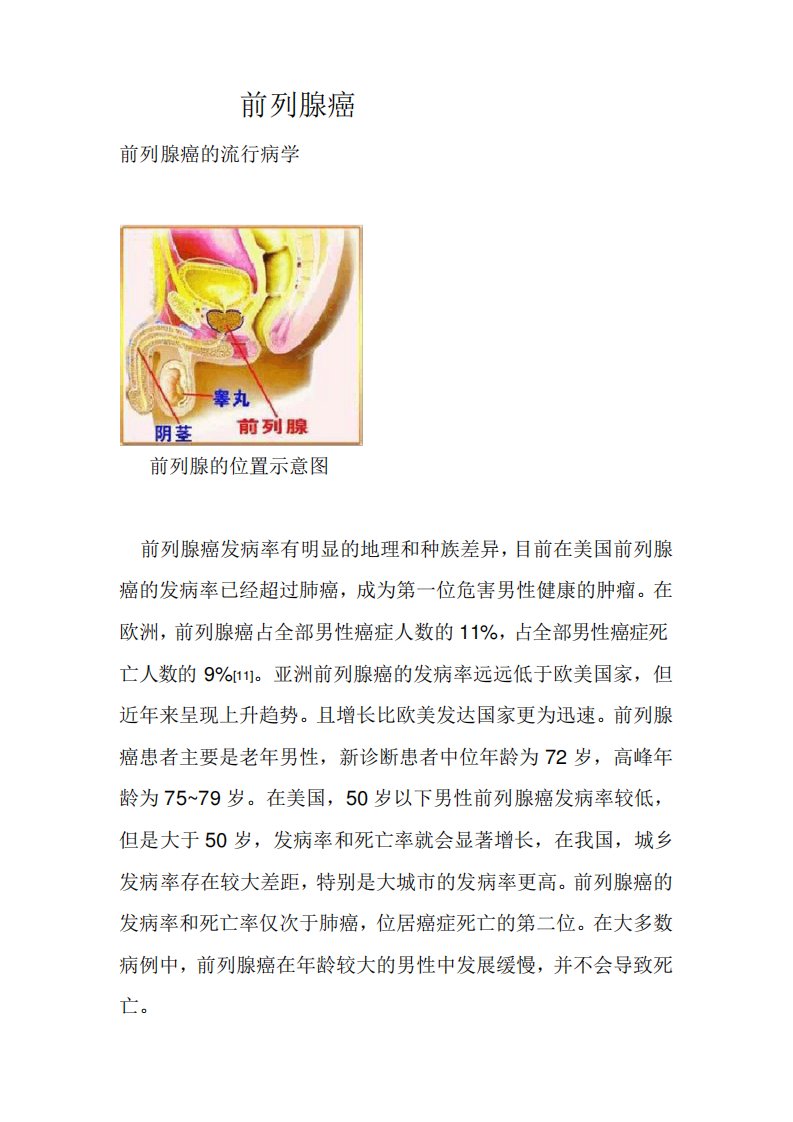 前列腺癌科普文章