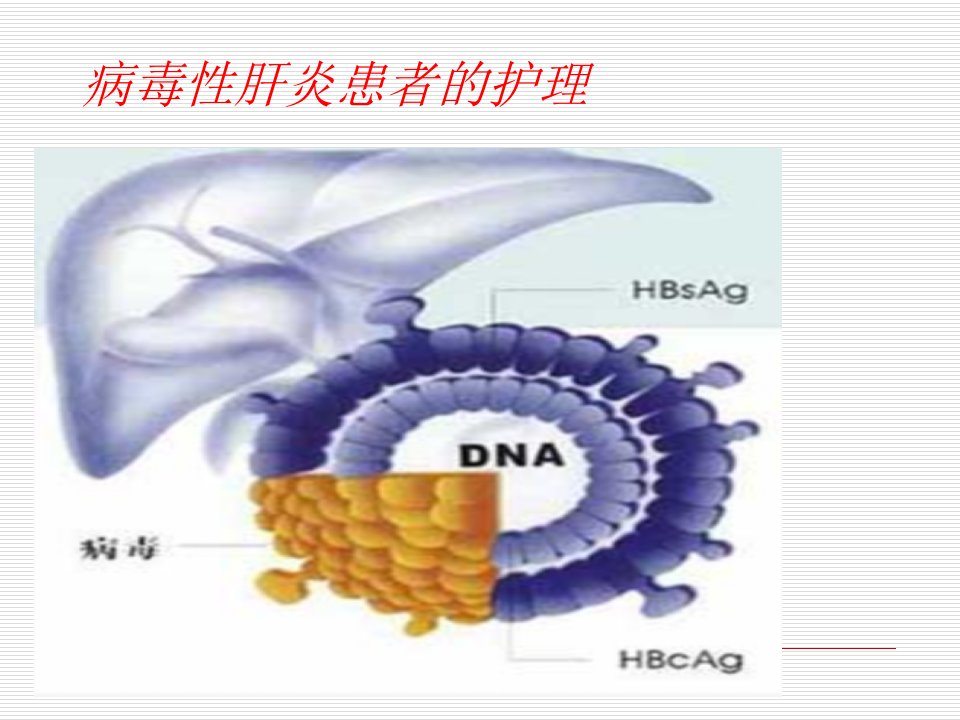 病毒性肝炎患者护理