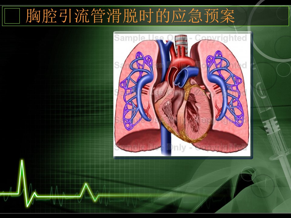 胸腔引流管滑脱时的应急预案