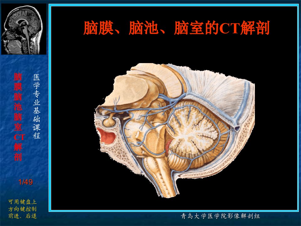 脑膜、脑池、脑室CT解剖.ppt