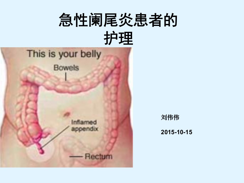 急性阑尾炎患者的护理