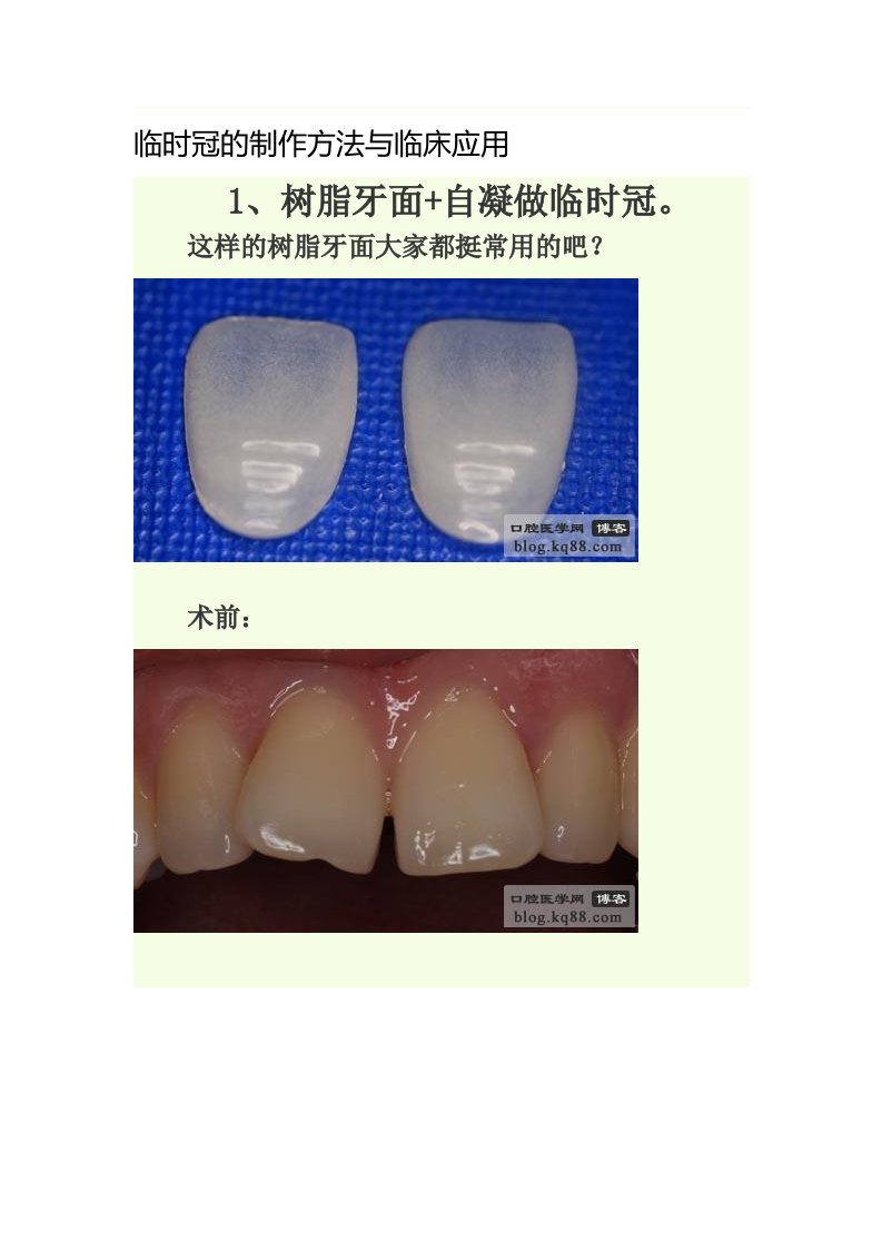 临时冠的制作方法与临床应用