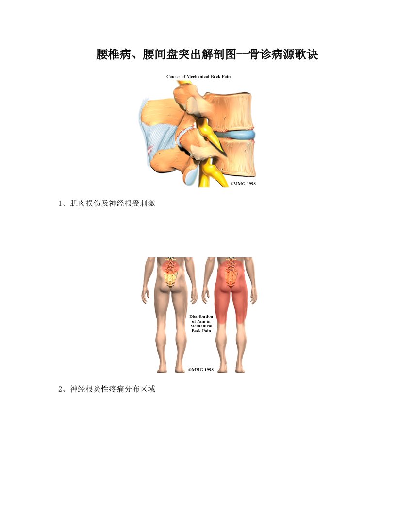 腰椎病、腰间盘突出解剖图--骨诊病源歌诀