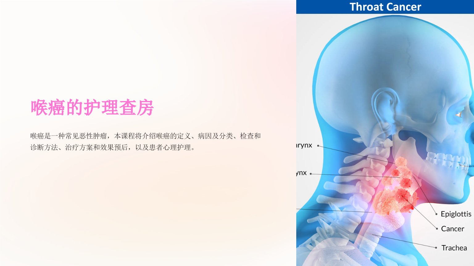 《喉癌的护理查房》课件