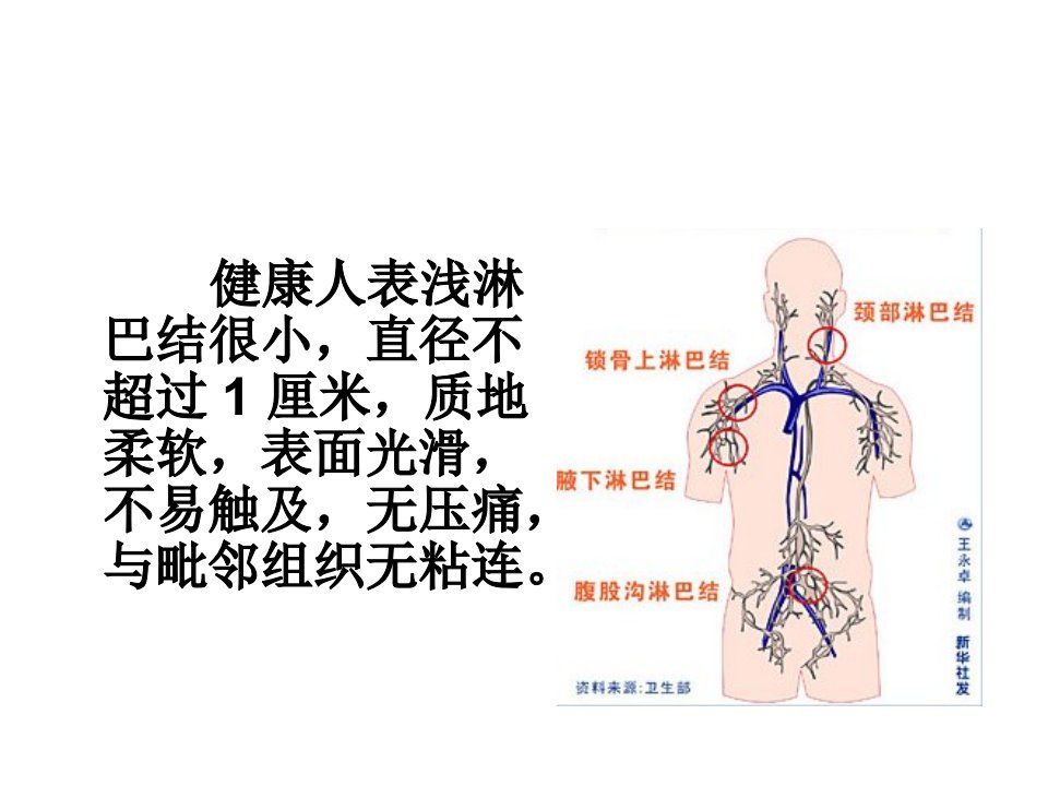 浅表淋巴结ppt课件