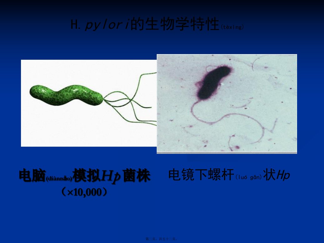 医学专题依赖于胃镜活检快速尿素酶试验RUT