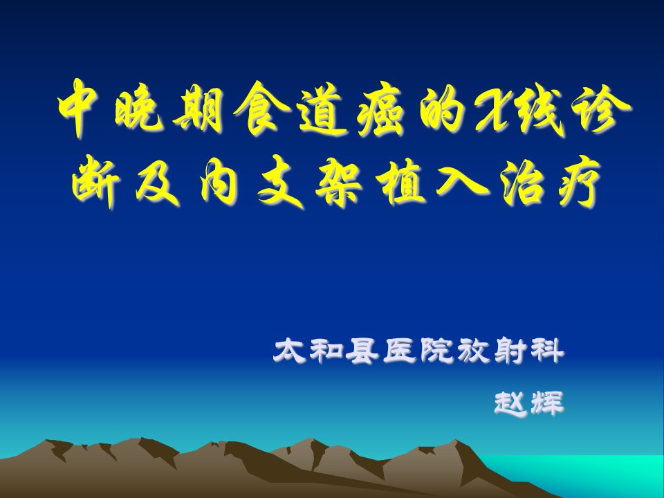 中晚期食道癌的X线诊断及内支架植入治疗