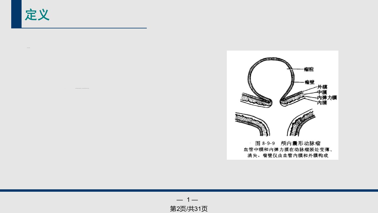 颅内动脉瘤CTA诊断