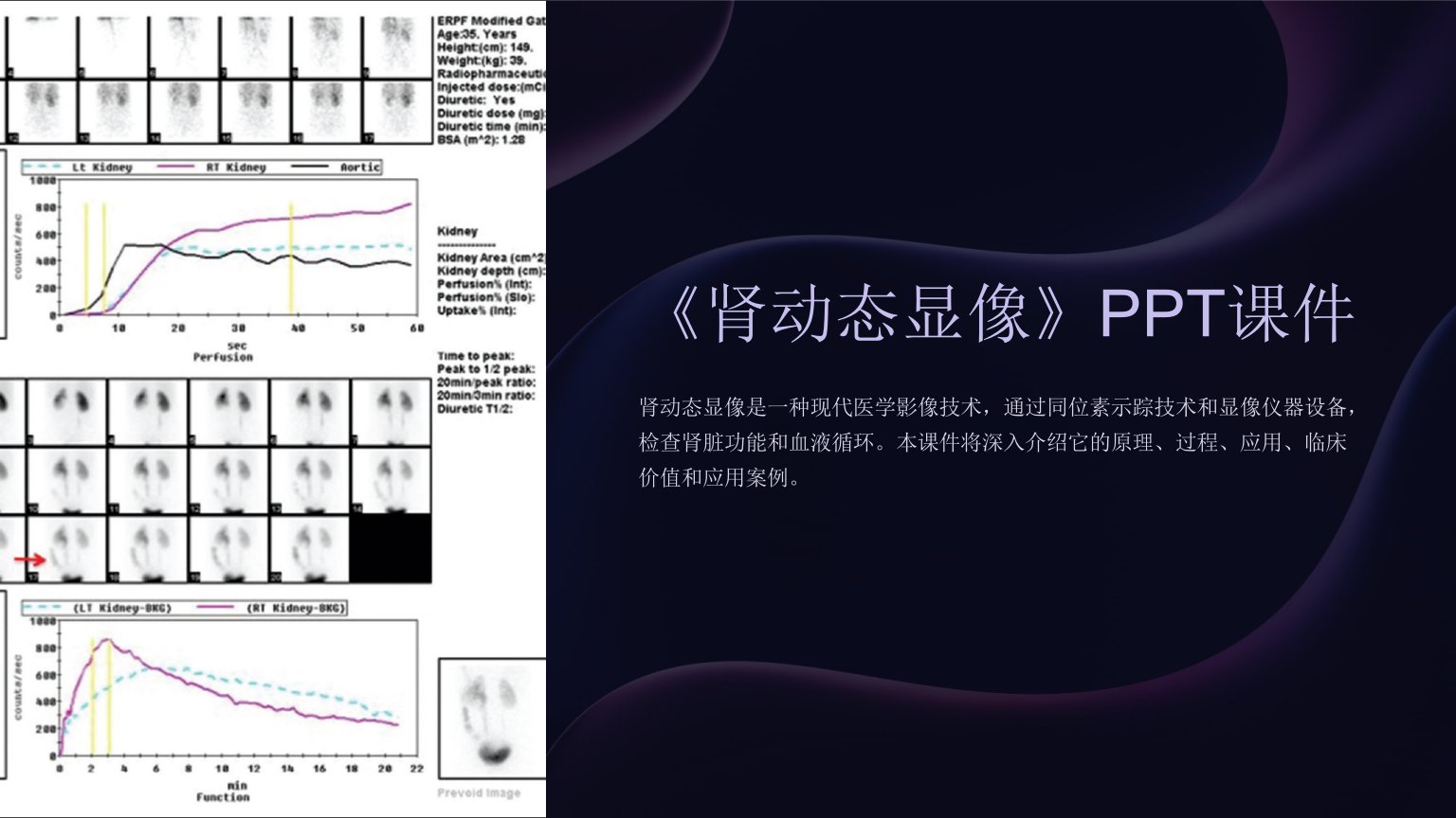 《肾动态显像》课件