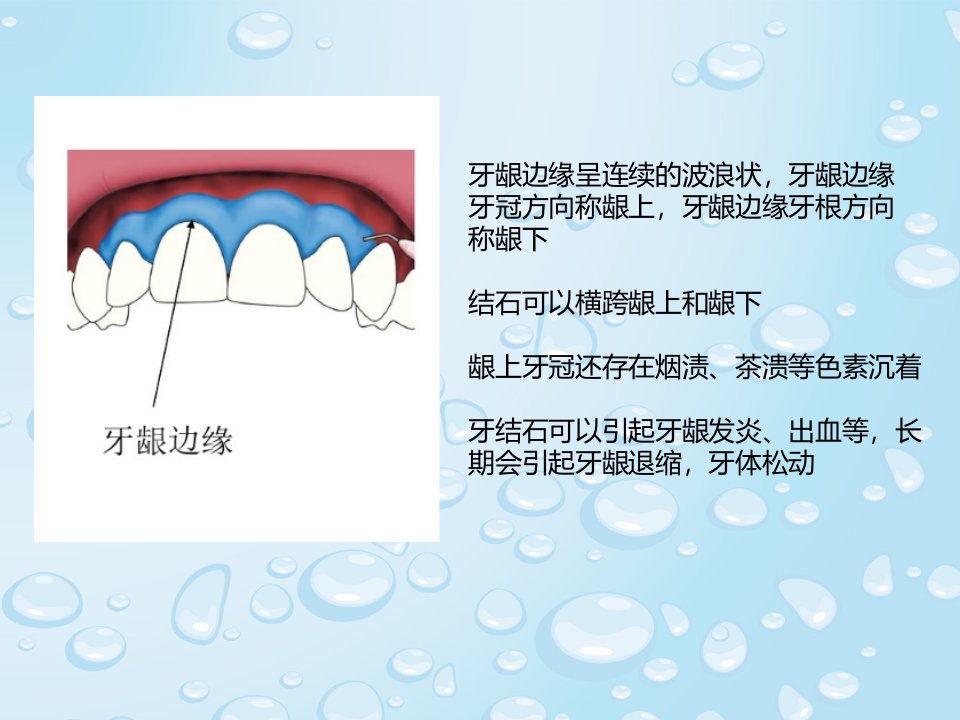 洗牙专题宣讲讲义