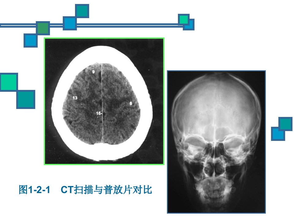 医学影像诊断学总论