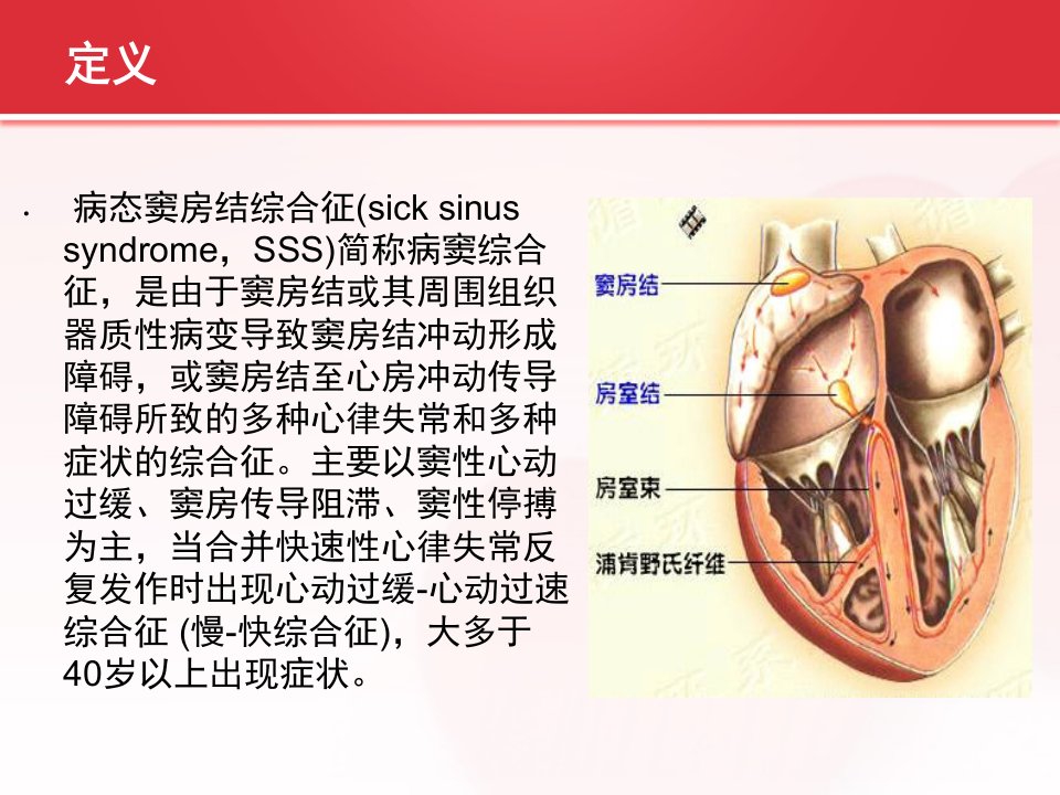 病态窦房结综合症的护理查房PPT课件