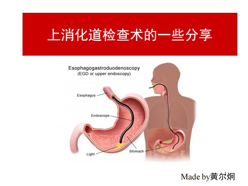 胃镜检查术