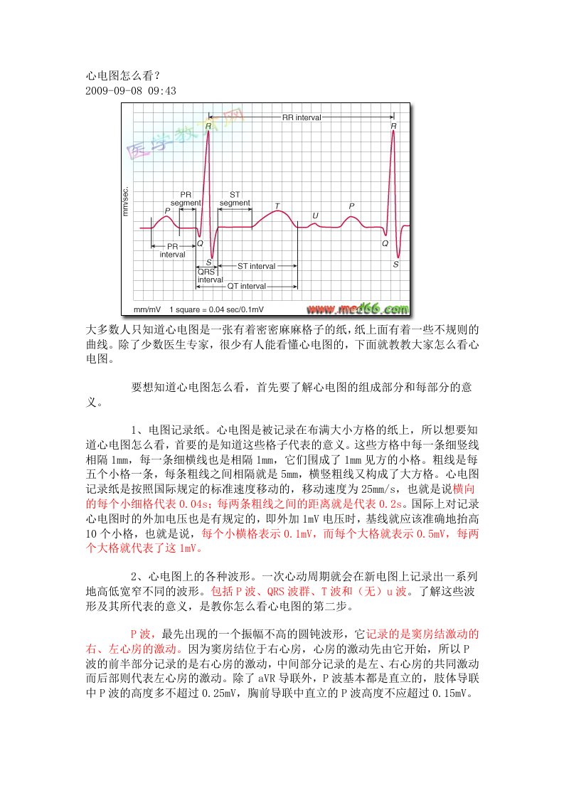 心电图怎么看