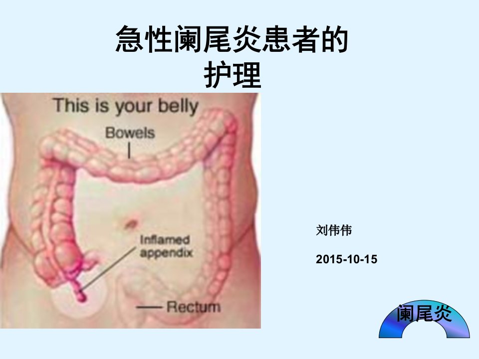 急性阑尾炎患者护理