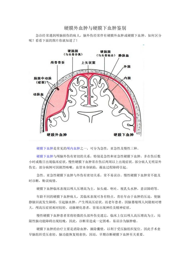 硬膜外血肿与硬膜下血肿鉴别