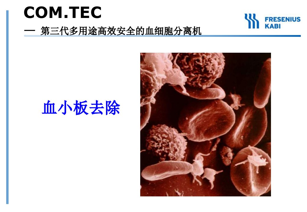 《议3血小板去除》PPT课件