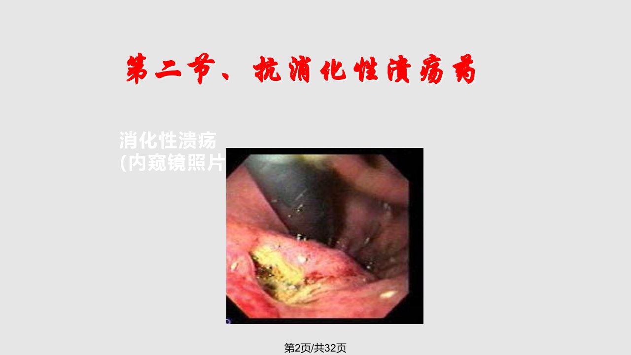 药理学消化系统用药