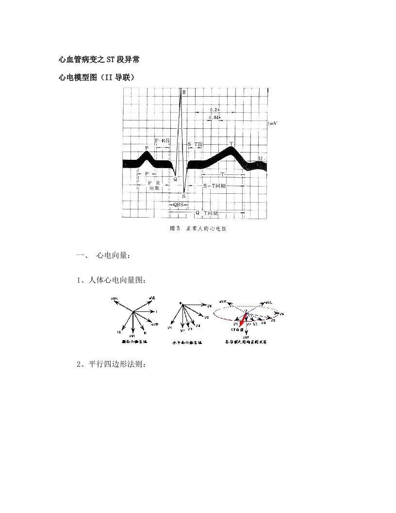 心血管病变之ST段异常