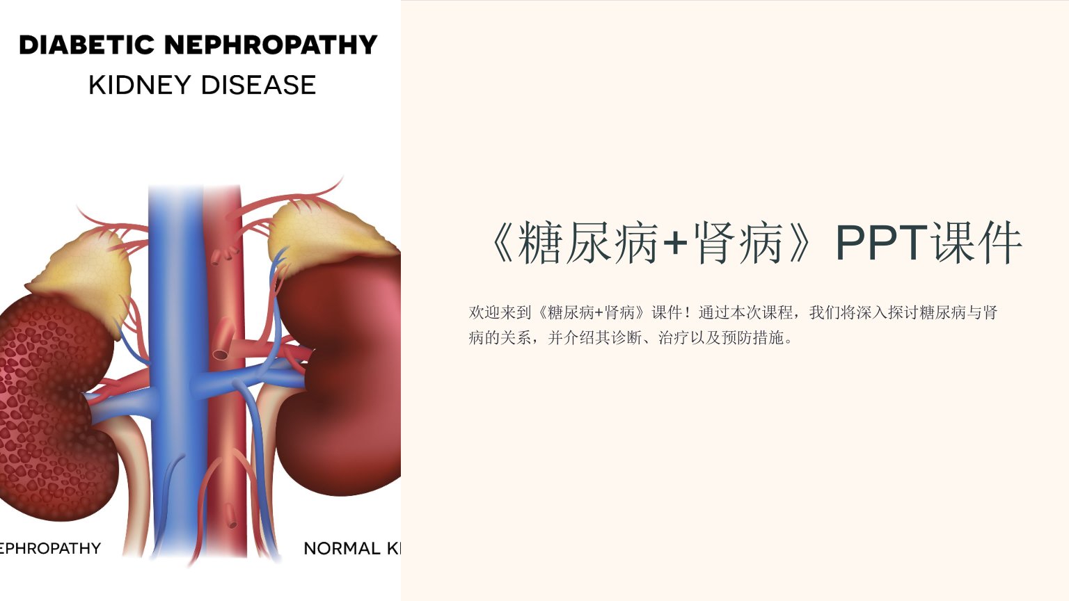 《糖尿病+肾病》课件