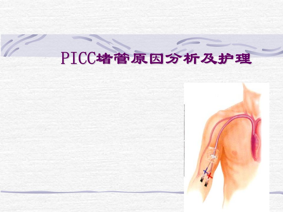 picc堵管原因分析及护理