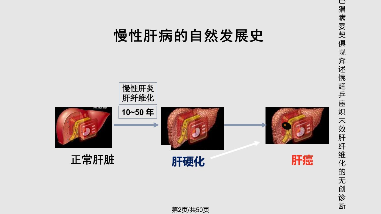 精华肝纤维化的无创诊断重庆医科大学附属第二医院张大志