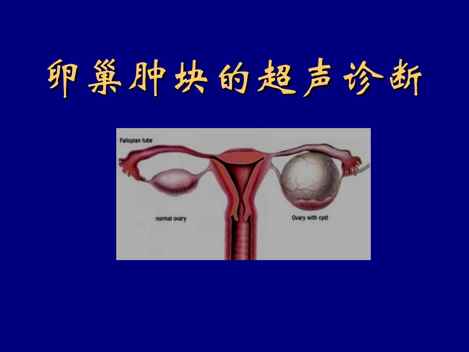 卵巢肿块的超声诊断