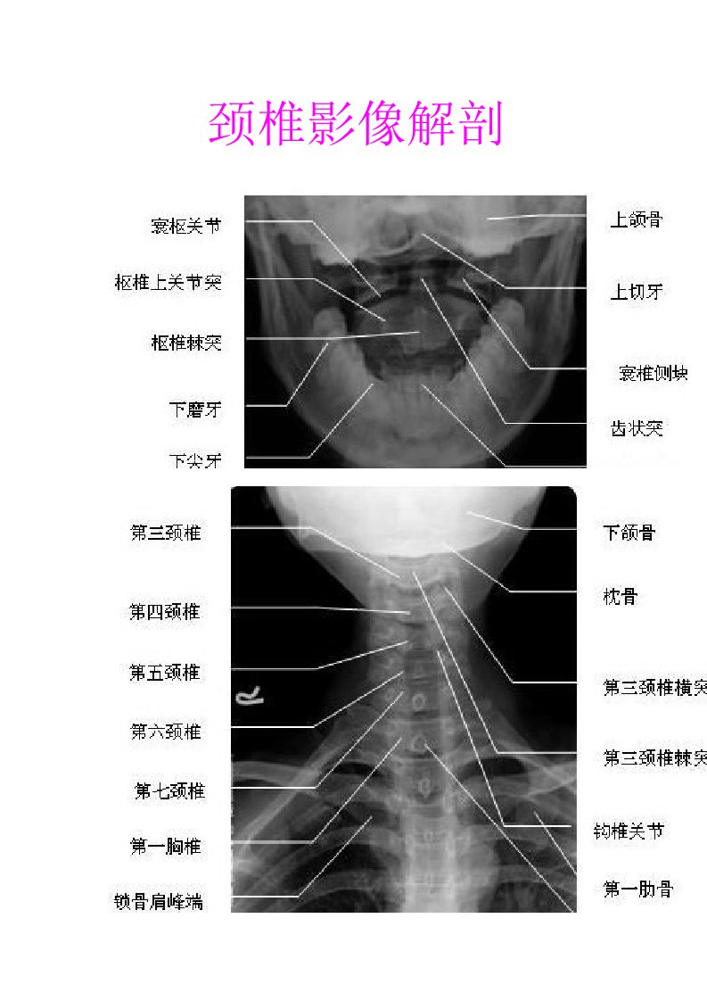 《颈椎x线DR片》