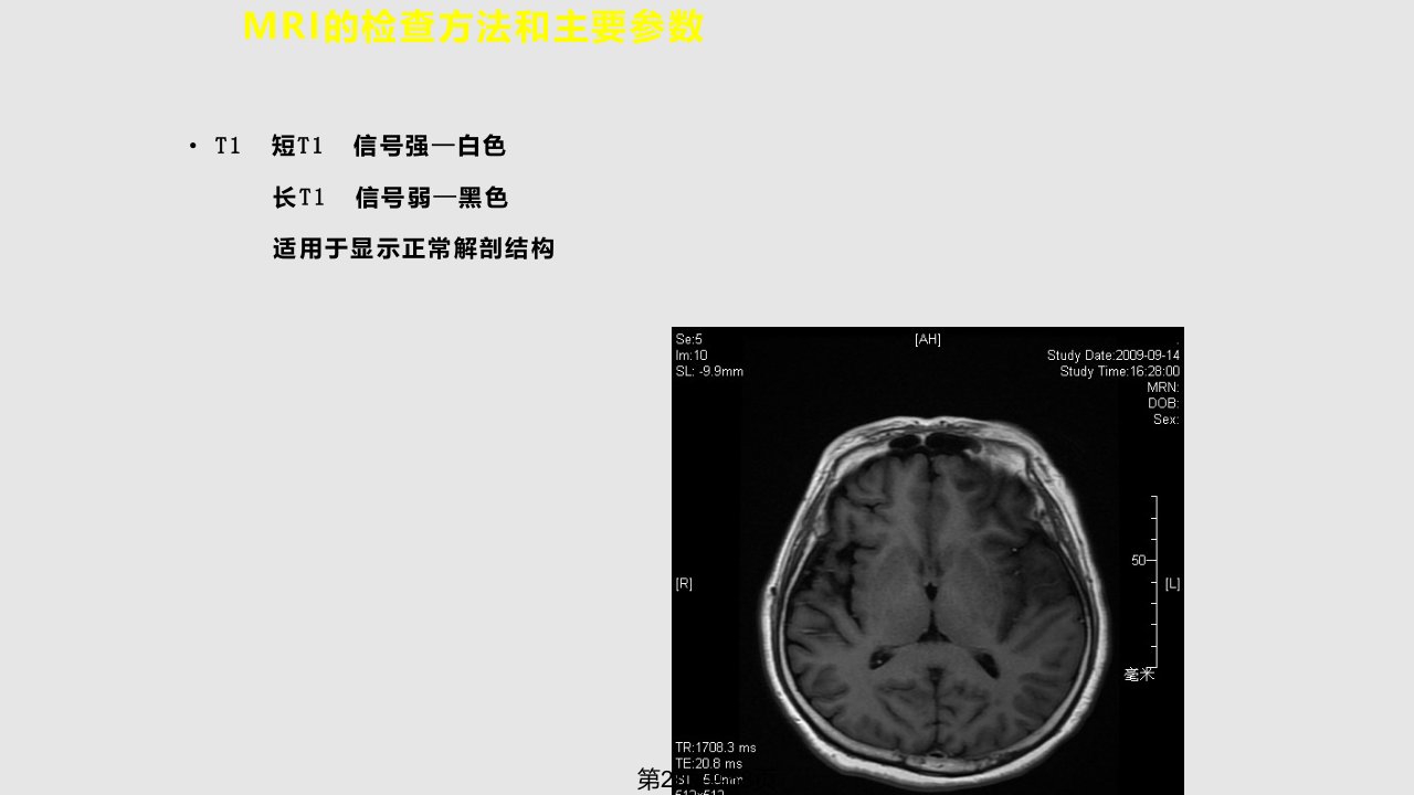 脑部磁共振呈像