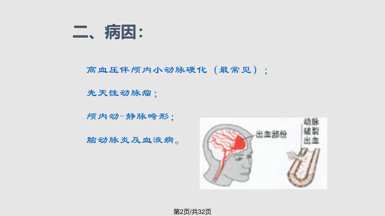 小讲课脑出血业务学习