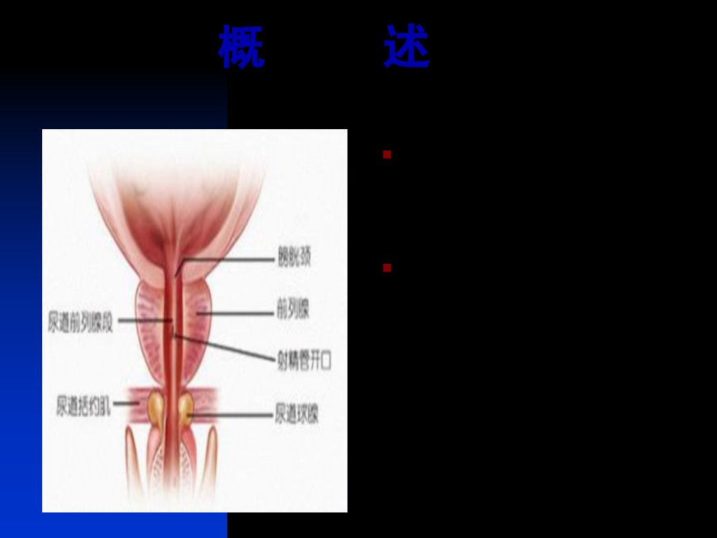 医学专题前列腺炎