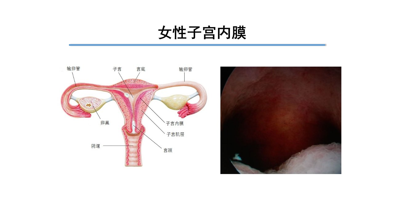 ERA评估子宫内膜容受性的价值ppt课件