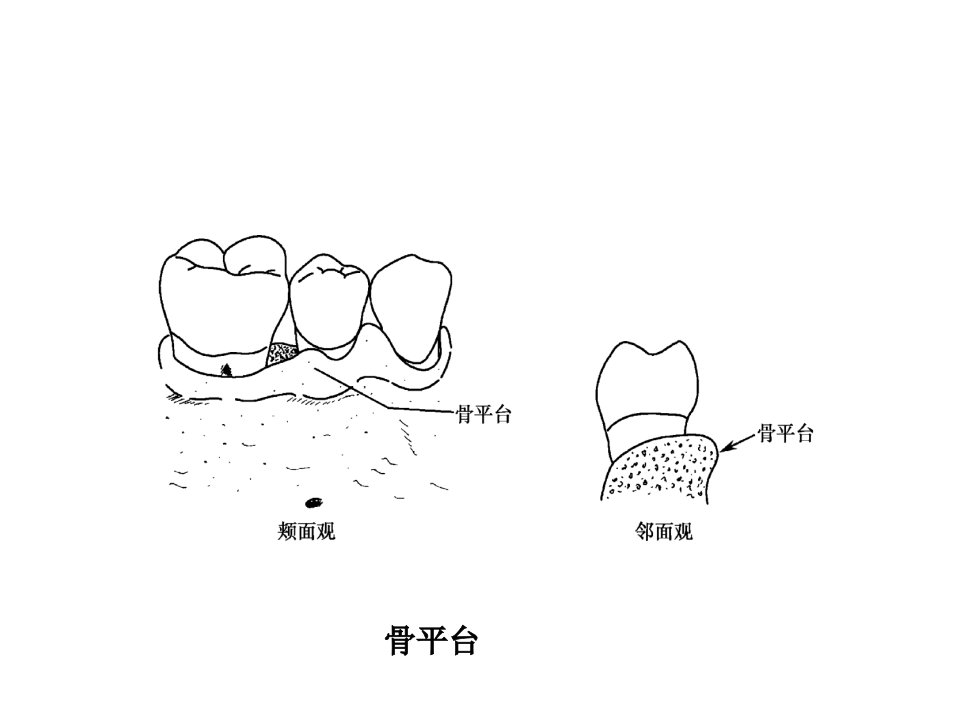 牙周病学第四版4ppt课件