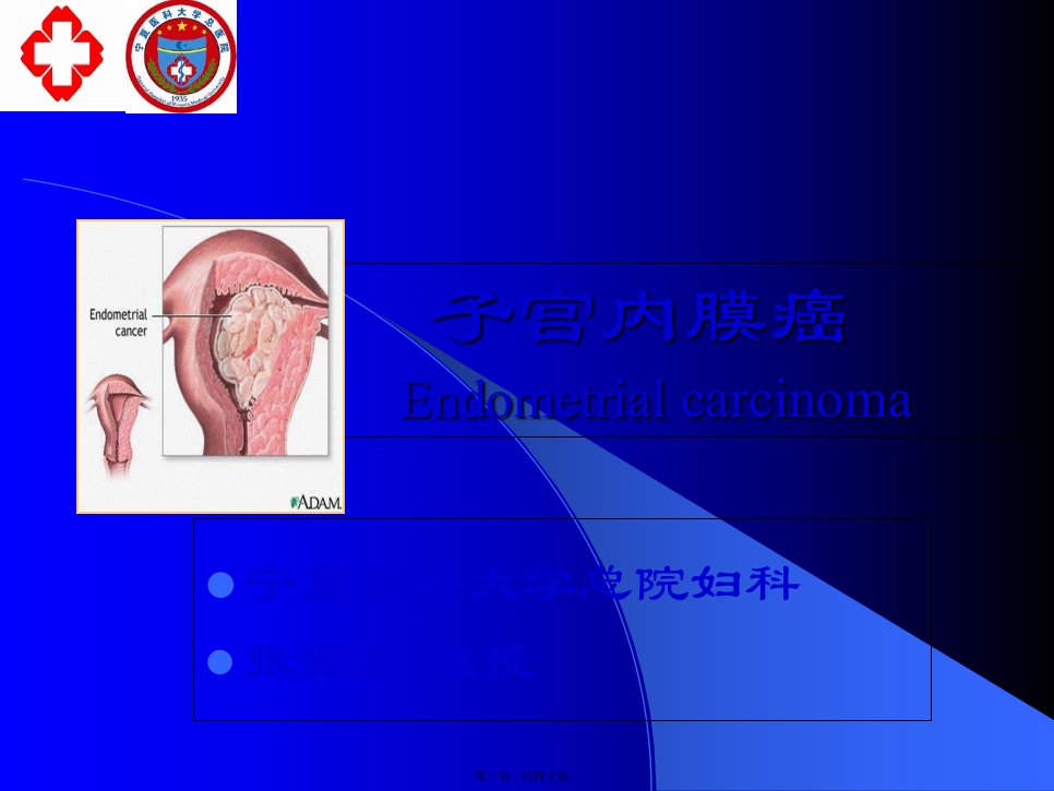 子宫内膜癌本科