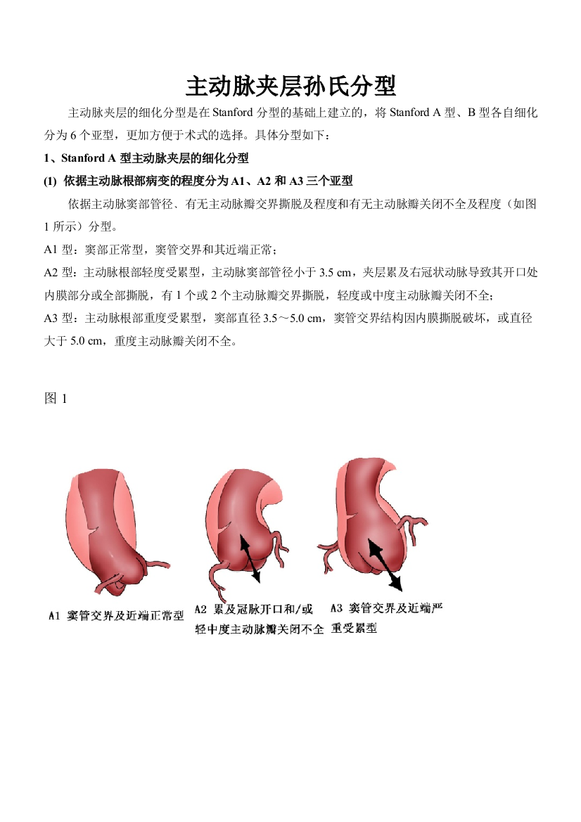 夹层分型及治疗方式