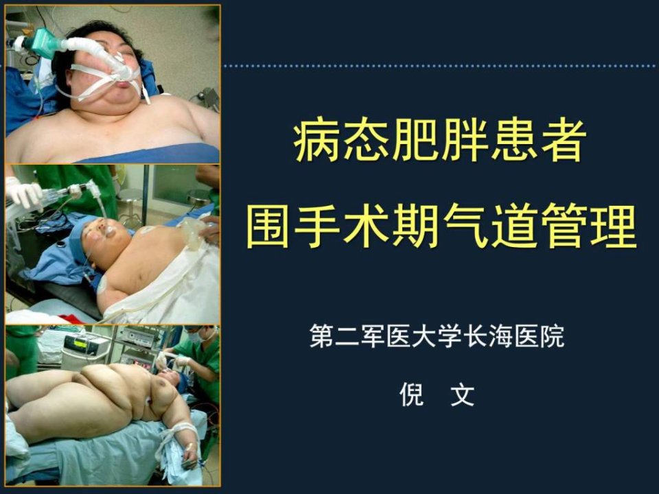 病态肥胖患者围手术期的的气道管理长海麻醉周倪课件