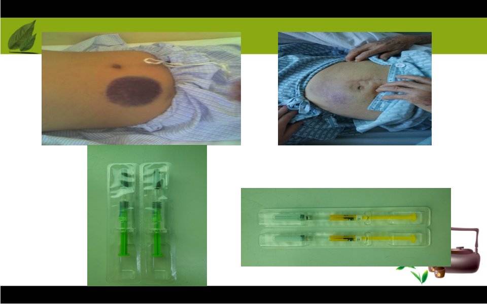 低分子肝素使用及注意事项PPT课件