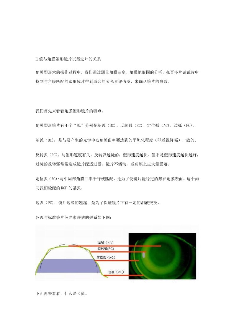 E值与角膜塑形镜片试戴选片的关系