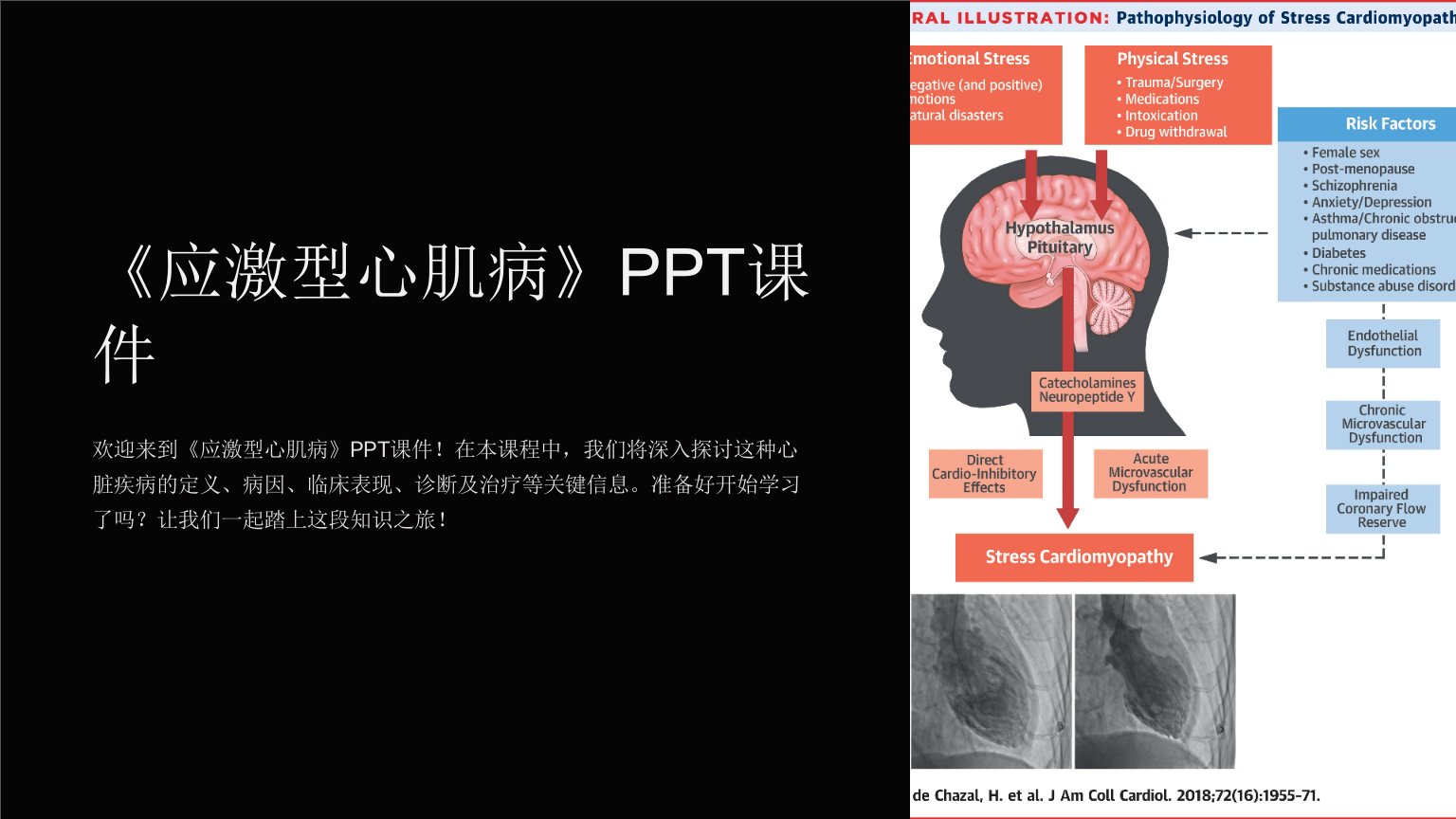 《应激型心肌病》课件