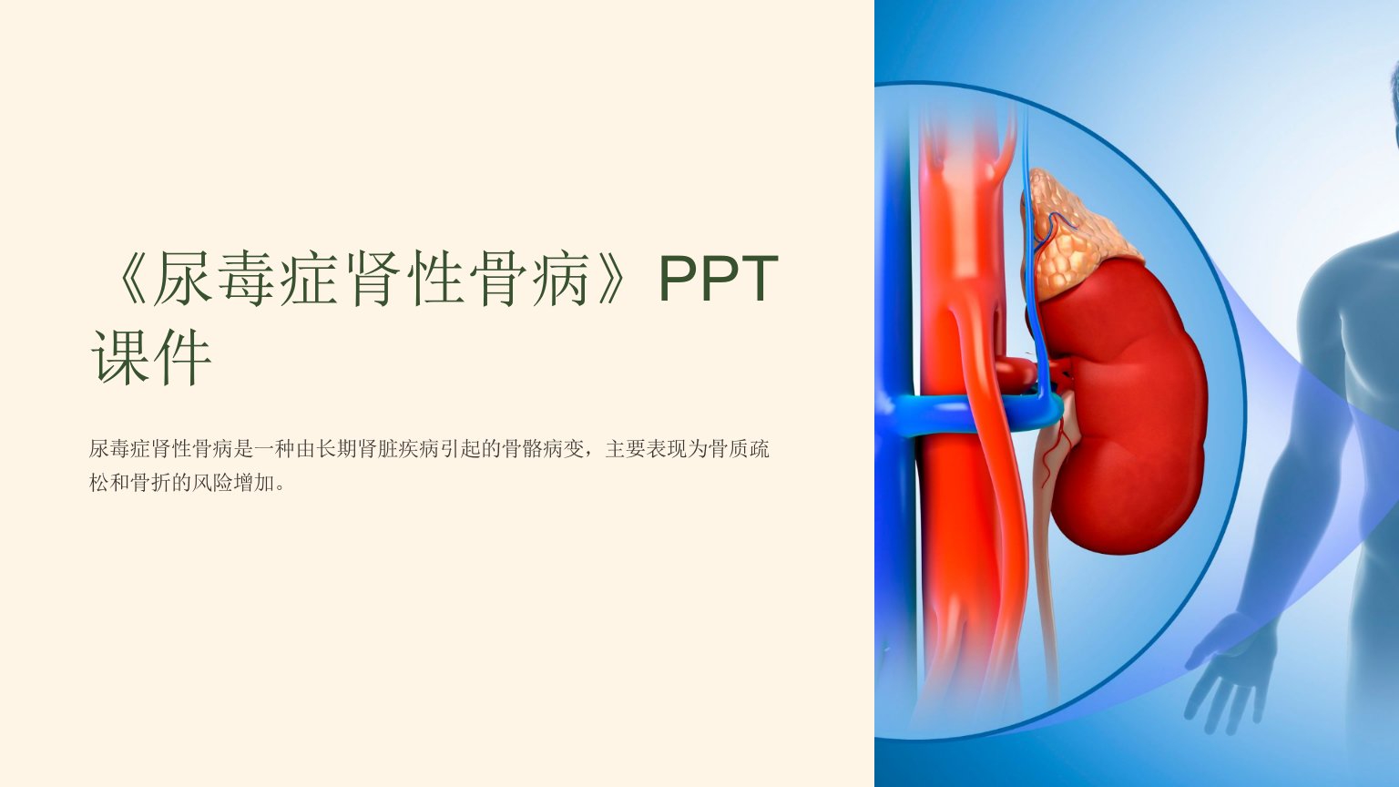 《尿毒症肾性骨病》课件