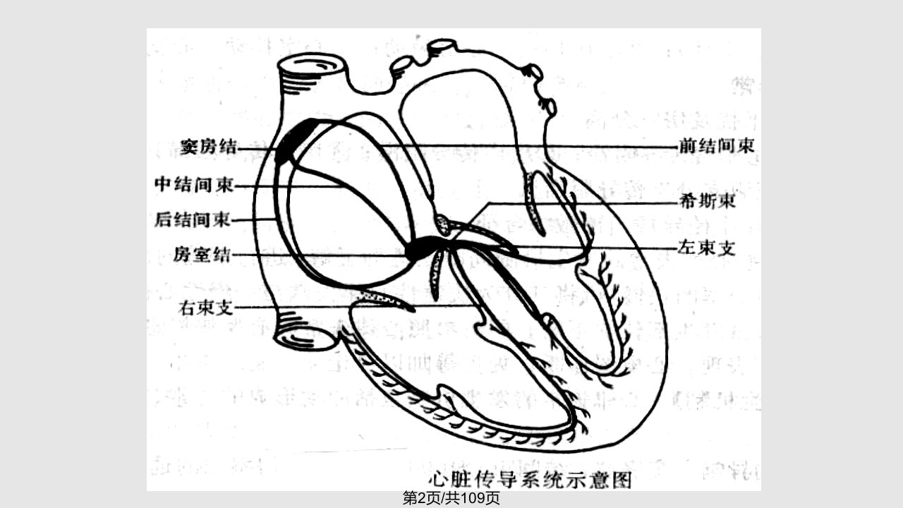 第三篇心律失常2