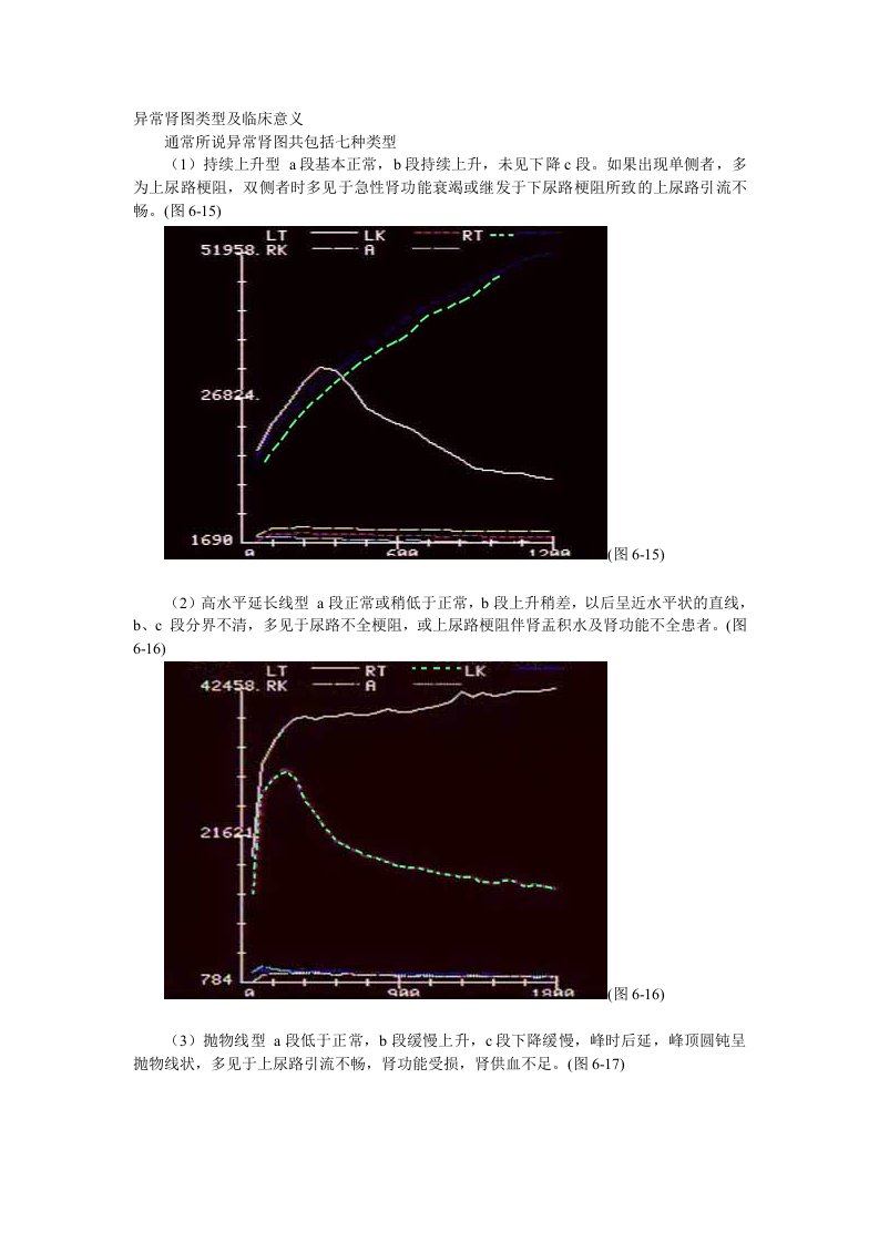 异常肾图类型及临床意义