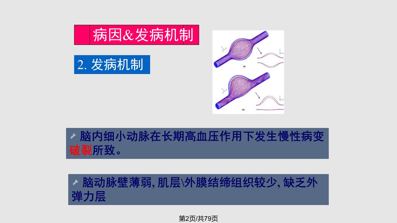 脑血管疾病脑出血