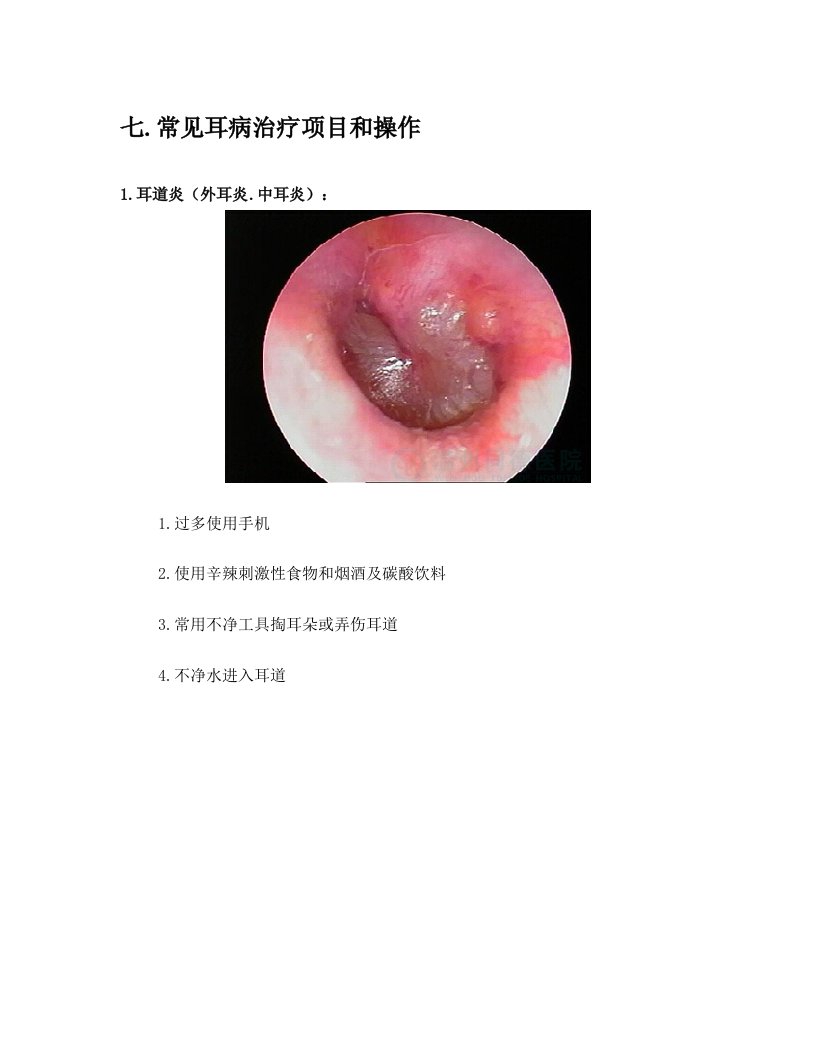 常见耳病治疗项目和操作