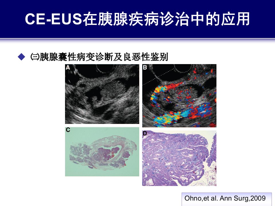 造影增强EUS与胰腺疾病诊治4