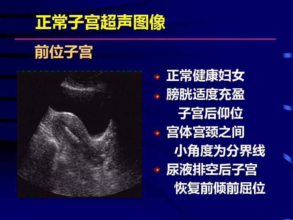 妇科疾病超声检查图谱解析105页PPT1课件